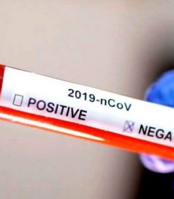 teste-negativo-covid19